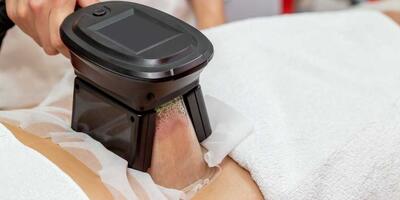 هزینه هر جلسه کرایولیپولیز در کلینیک های لاغری تهران