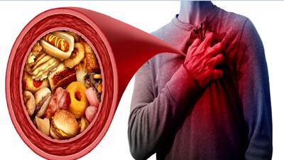  یافته‌های غیرمنتظره در مورد تأثیر چربی اشباع بر سلامت قلب