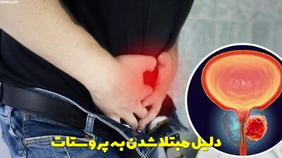 دلیل مبتلا شدن به پروستات چیست و چگونه درمان می شود؟