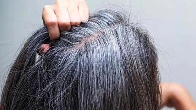  6 روش علمی برای به تاخیر انداختن سفیدی موها