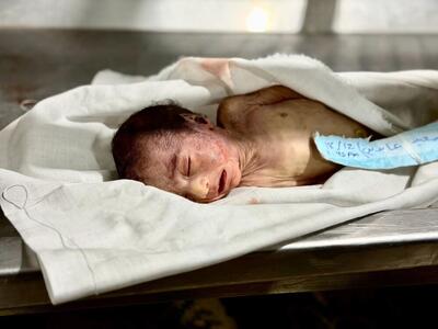  حماس: شهادت کودکان غزه بر اثر سرما نتیجه تداوم محاصره است