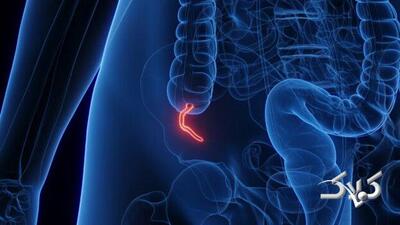 شیوع یک بیماری نادر میان جوانان پزشکان را نگران کرده - مجله اینترنتی کولاک