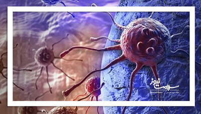 هر توموری سرطانی نیست