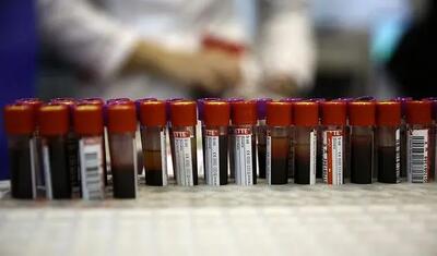 شهرواندان استان هرمزگان برای انتقال خون مراجعه کنند + آدرس مراکز انتقال خون