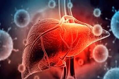 اگر کبدتان چرب است فوری بخوانید | خستگی مزمن، درد سمت راست شکم و زردی پوست هشداردهنده است