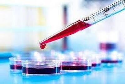  خون پیر مغز را آلزایمری می‌کند!