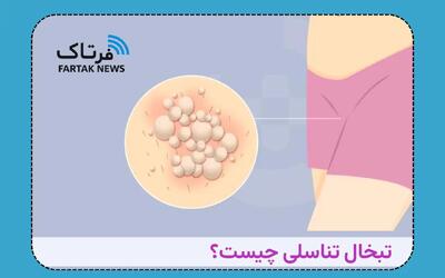  هشدار جدی؛ تبخال تناسلی؛ ویروسی که در خواب هم منتقل می‌شود!