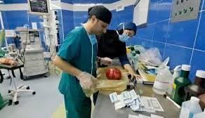  توده بزرگی از مو از معده کودک ۱۱ ساله کاشانی بیرون کشیده شد