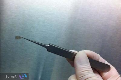 ایمپلنت ریز سلولی؛ امید تازه برای بازگرداندن بینایی بیماران مبتلا به تحلیل لکه‌ای