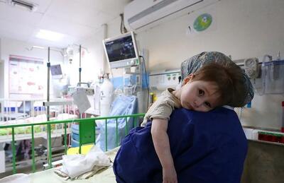 علائم و عوارض آنفلوانزا در کودکان/ ۳ اقدام مهم برای پیشگیری از ابتلا