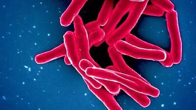 آمار وحشتناک کشنده‌ ترین بیماری عفونی جهان در سال 2024: 1.23 میلیون جان باخته