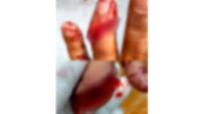  درگیری  نگهبانان هفت تپه با سارقان/ 2 انگشت یک حراستی قطع شد