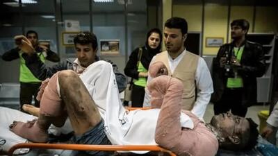 در ایران چند نفر بر اثر سوختگی جان خود را از دست می‌دهند؟