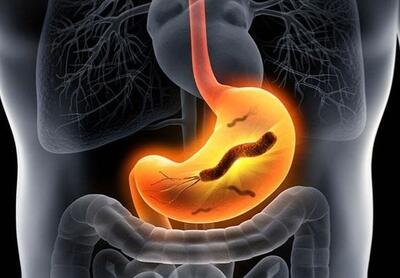 هلیکوباکتر پیلوری یا اچ پیلوری معده چیست؟