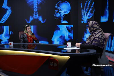  تندرستی؛ تولید اولین نانوداروی ترمیم شکستگی استخوان در ایران