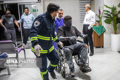 پانسمان‌های نوین سوختگی بیمه شد