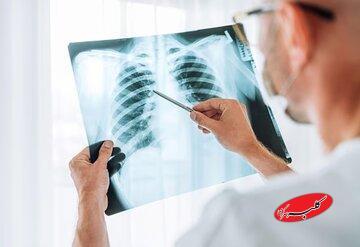 چرا آنفلوآنزا گاهی کشنده می‌شود؟ - کلبه سرگرمی