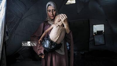 تداوم سوءتغذیه حاد در غزه با وجود خروج از قحطی
