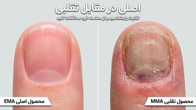 عوارض خاموش و هولناک مواد تقلبی کاشت ناخن؛ هشدار جدی به بانوان و ناخن‌کاران