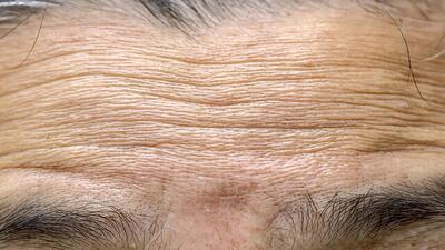  ترکیب فناوری نانو و زیست‌فناوری برای جوان‌سازی طبیعی و ماندگار پوست