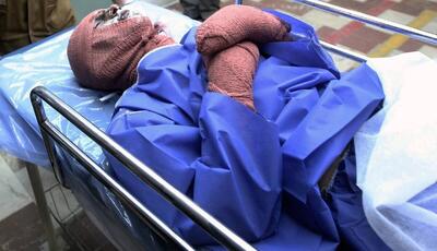 آمار عجیب سوختگی در ایران ؛ ۳۰۰ هزار نفر در سال!