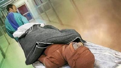 سوختگی در ایران؛ آماری فراتر از حادثه / سالی ۳۰۰۰۰۰ سوختگی و زنگ خطر ایمنی در کشور