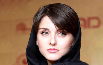  بازیگر زخم کاری با این استایل همه را سورپرایز کرد