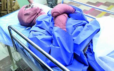 درخواست از رئیس جمهور؛ اول دی روز پیشگیری از سوختگی نامیده شود