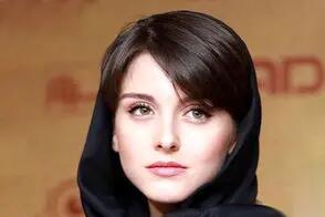  بازیگر زخم کاری با این استایل همه را سورپرایز کرد