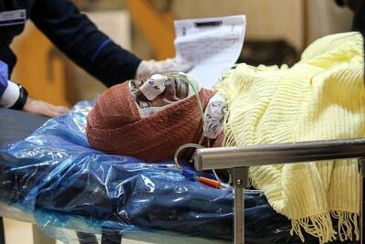 مواظب باشید نسوزید؛ یک تخت سوختگی هم نداریم| بعضی بیماران سوختگی حتی ۴۰ تا ۵۰ تا عمل جراحی دارند