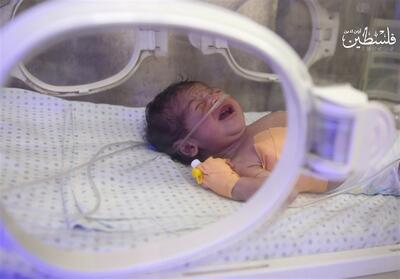 مراقبت‌های مستمر پس از ترخیص کلید سلامت پایدار نوزادان نارس - تسنیم