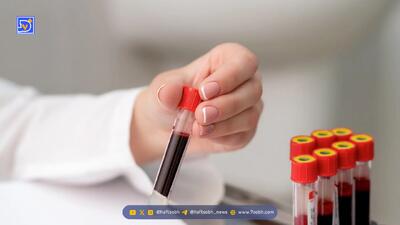  علائم کمبود هموگلوبین خون