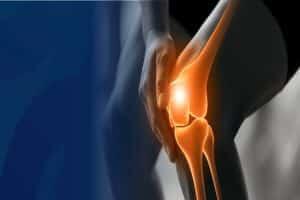  آیا آمپول PRP برای کاهش درد زانو موثر است؟
