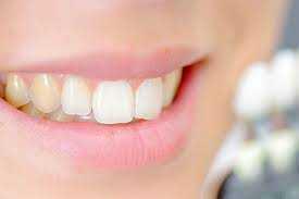 دندان‌ها باید حفظ و ترمیم شوند، نه کشیده! / هشدار دندانپزشکان درباره یک اشتباه رایج / عواقبی که کمتر کسی می‌داند