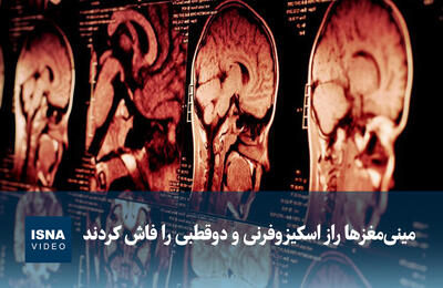  ویدیو/ مینی‌مغزها راز اسکیزوفرنی و دوقطبی را فاش کردند
