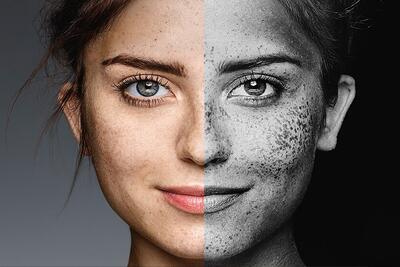 آلودگی هوا؛ دشمن نامرئی پوست