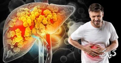 تنها راه درمان کبد چرب مشخص شد؛ معجزه می‌کند! - مجله اینترنتی کولاک