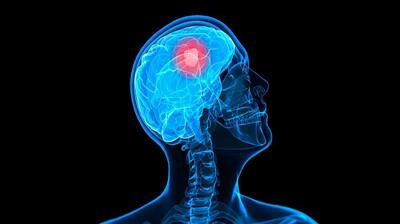 میگنا - نوروبیولوژی تاب‌آوری چیست ؟