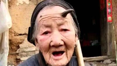 چرا برخی انسان‌ ها شاخ درمی‌ آورند؟ رازهای عجیب و شگفت‌ انگیز!