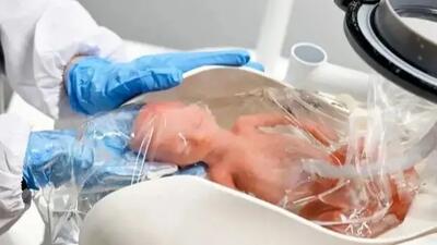  نجات نوزادان زودرس با تکنولوژی رحم مصنوعی