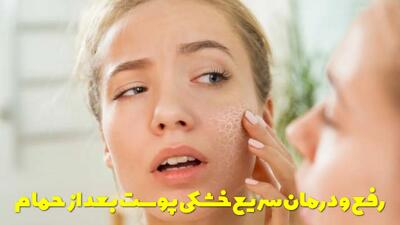  راهکارهای رفع و درمان سریع خشکی پوست صورت و بدن بعد از حمام