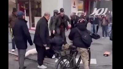  حمله وحشتناک سگ به کودکی در نیویورک
