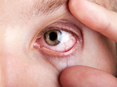 عینک بهتر است یا عمل لیزیک؟ / حقایقی که قبل از تصمیم‌گیری باید بدانید / ویدیوی مقایسه عینک و لیزیک از نظر فواید و معایب