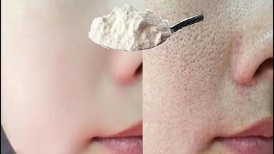  با این ماسک صورت / در عرض ۳ روز منافذ باز پوست کمتر شده و رنگ پوستت فوراً روشن تر می شه.