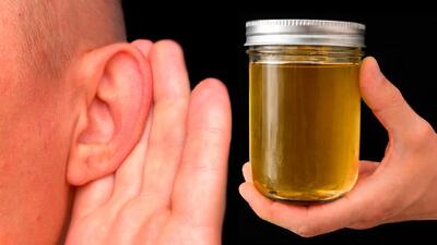  جرمگیری عمیق گوش / دیگه گوشات وزوز نمیکنه و زنگ نمیزنه
