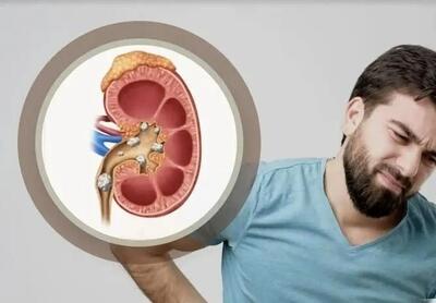 دشمن پنهان کلیه‌ها را بشناسید