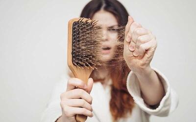  جلوگیری از ریزش مو با این ۷ داروی گیاهی