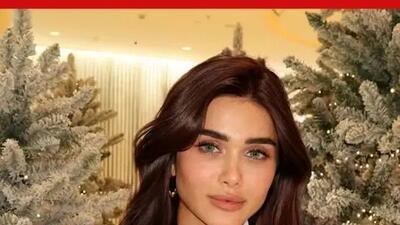  عکس ها / هیوا امین دختر ایرانی زیباترین زن خاورمیانه در سال ۲۰۲۵ شد/ عکس قبل و بعد از عمل زیبایی مدل ایرانی
