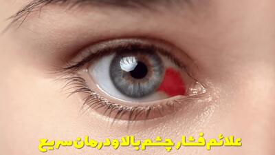  علائم فشار چشم بالا + درمان سریع و بهترین قطره برای کاهش فشار چشم