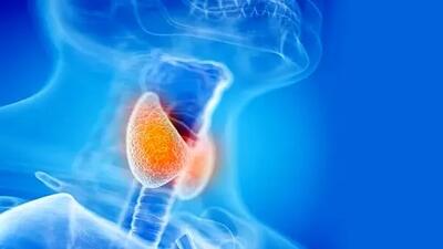 نشانه‌های التهاب تیرویید